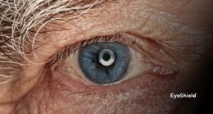 Starczowzroczność - przyczyny i objawy prezbiopii EyeShield