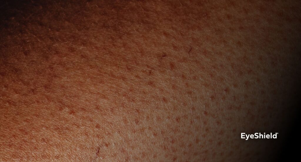 Dlaczego skóra słabnie