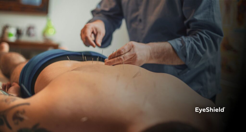Naturoterapia akupunktura